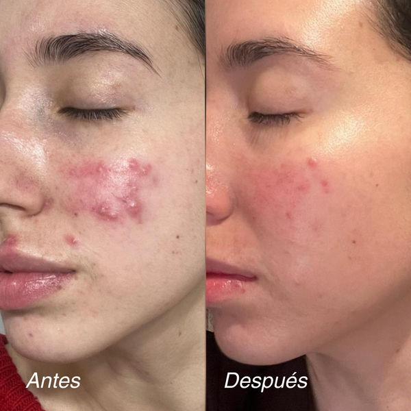 REDNESS CONTROL CREAM