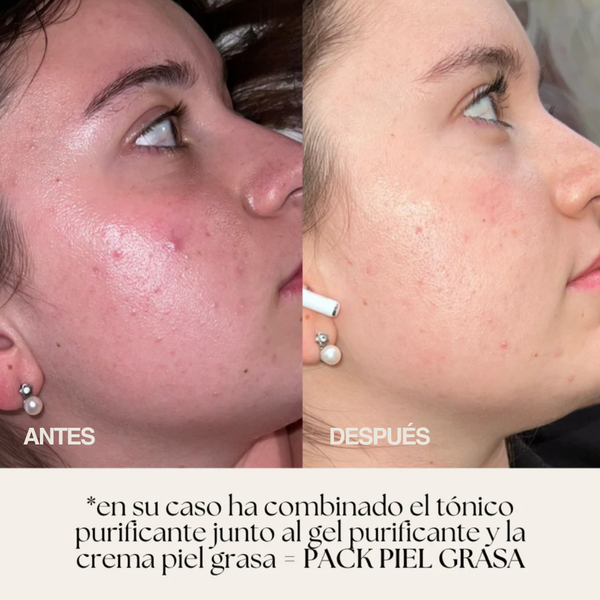 TÓNICO PURIFICANTE