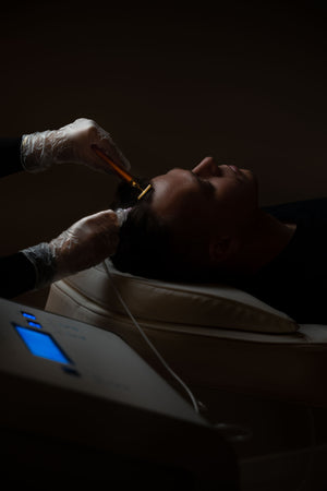 Carboxiterapia Capilar