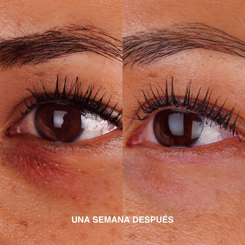 CONTORNO DE OJOS DESPIGMENTANTE