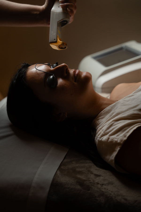 Láser para Acné Activo