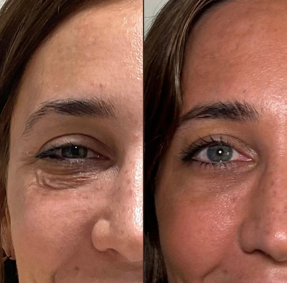 Polinucleótidos Oculares