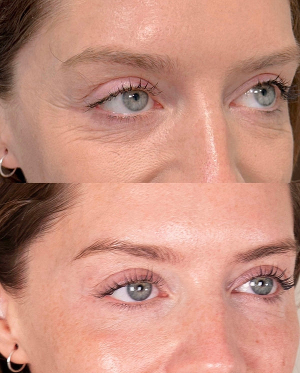 Polinucleótidos Oculares